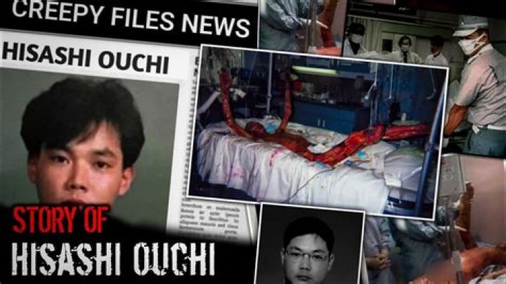 Hisashi Ouchi's Uncensored Photos: A Deeper Truth Revealed