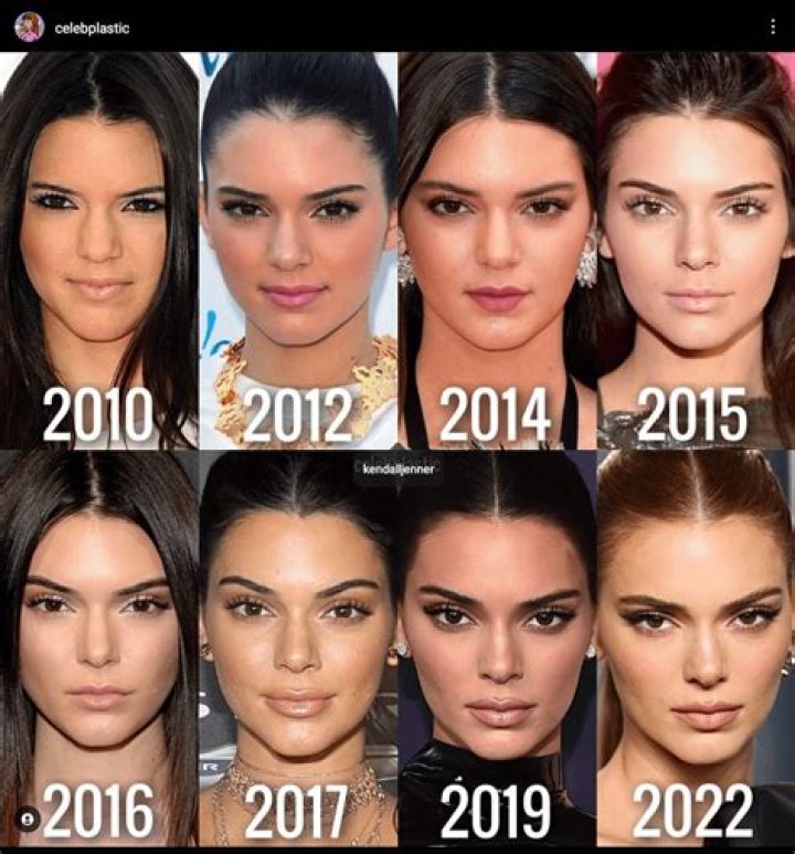 Kendall Jenner's Weight Gain Journey: Unveiling The Secret Behind Her Transformation
