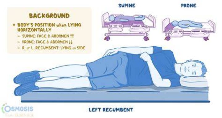 The Complete Guide To Decubito Dorsal Positioning And Prevention