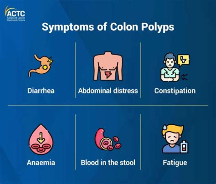 The Ultimate Guide To Colon Nodules Vs Polyps: Everything You Need To Know