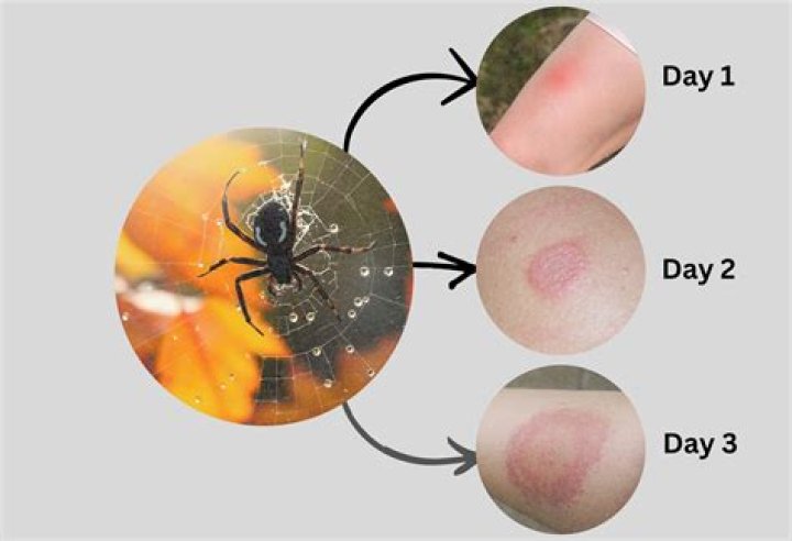 The Ultimate Guide To Spider Marks: A Comprehensive Wiki