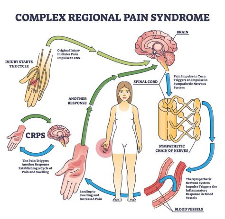 What Does CRPS Stand For In Finance: All You Need To Know